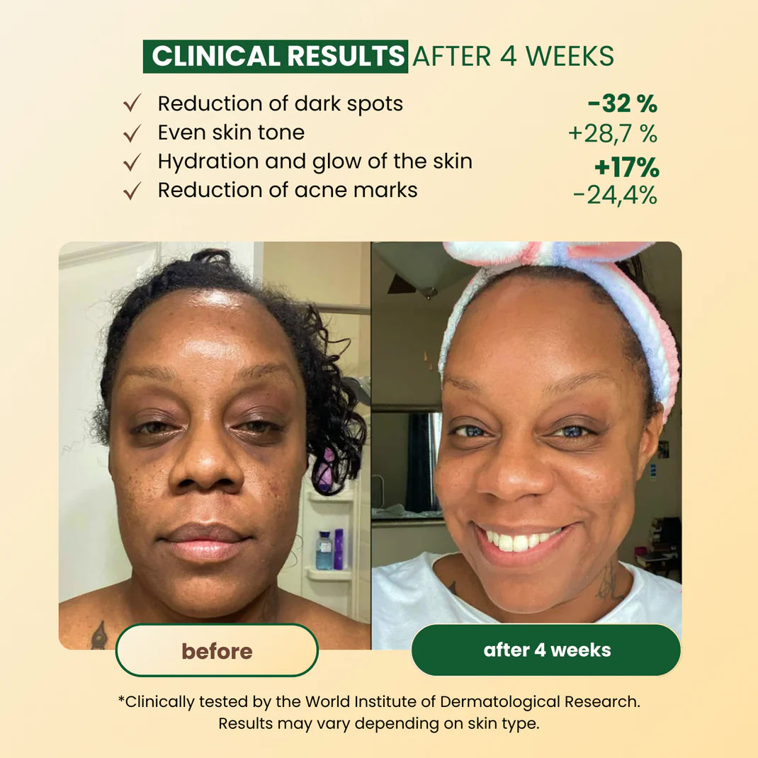 Jabón Despigmentante Antimanchas