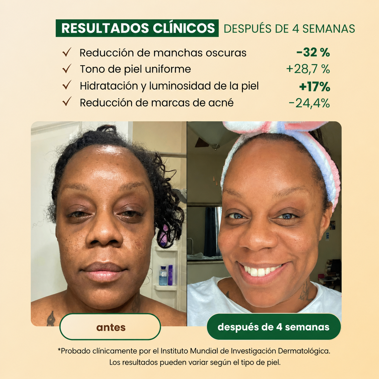 jabón Antimanchas de Cúrcuma y Ácido Kójico