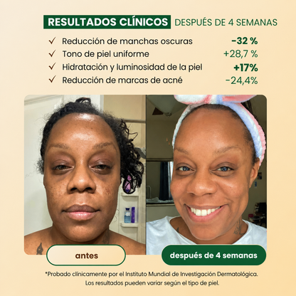 jabón Antimanchas de Cúrcuma y Ácido Kójico
